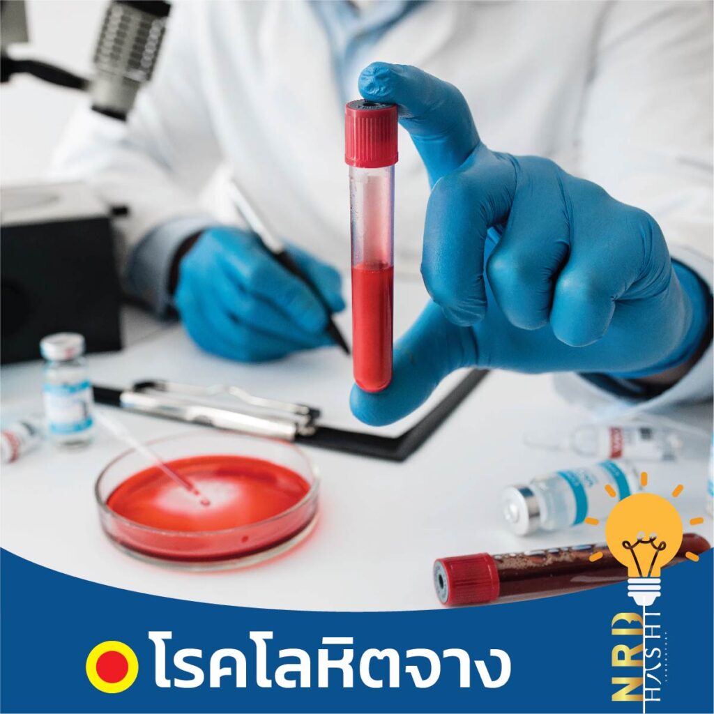 ง่วงนอนตลอดเวลา