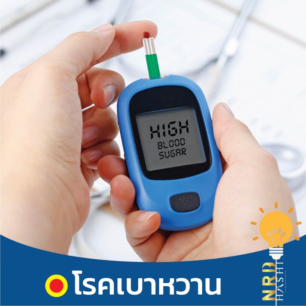 ง่วงนอนตลอดเวลา